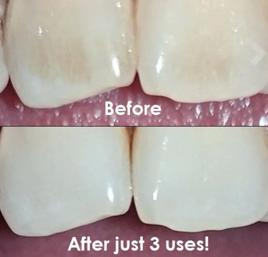 Teeth Cleaning Powder (Vitamins & Aloe Vera Infused)